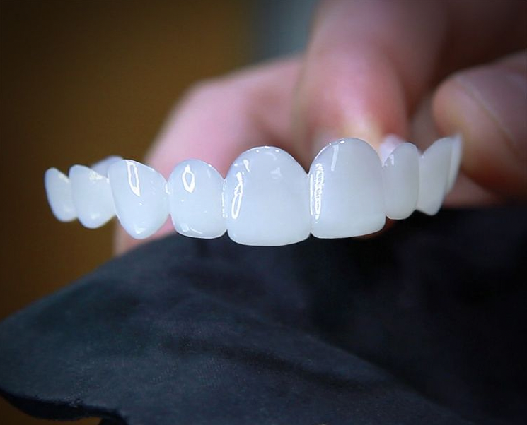 Lente Dental-White - Kit Superior + inferior 100% Moldável em qualquer Boca [compre 1 LEVE 2]