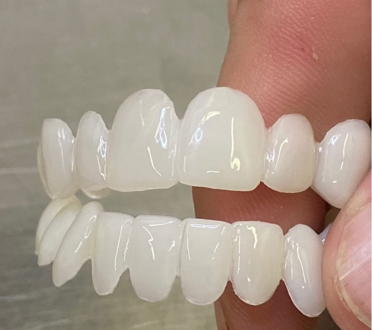 Lente Dental-White - Kit Superior + inferior 100% Moldável em qualquer Boca [compre 1 LEVE 2]