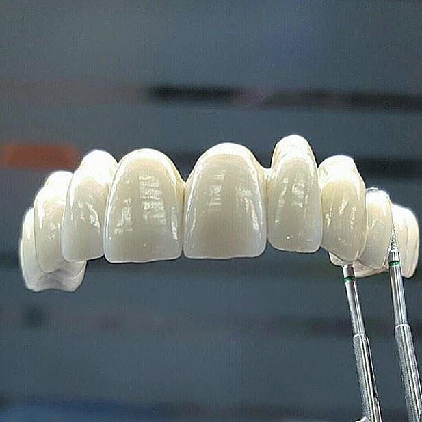 Lente Dental-White - Kit Superior + inferior 100% Moldável em qualquer Boca [compre 1 LEVE 2]